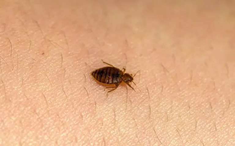 Close-up of a bed bug crawling on human skin, showing its oval brown body and segmented abdomen.