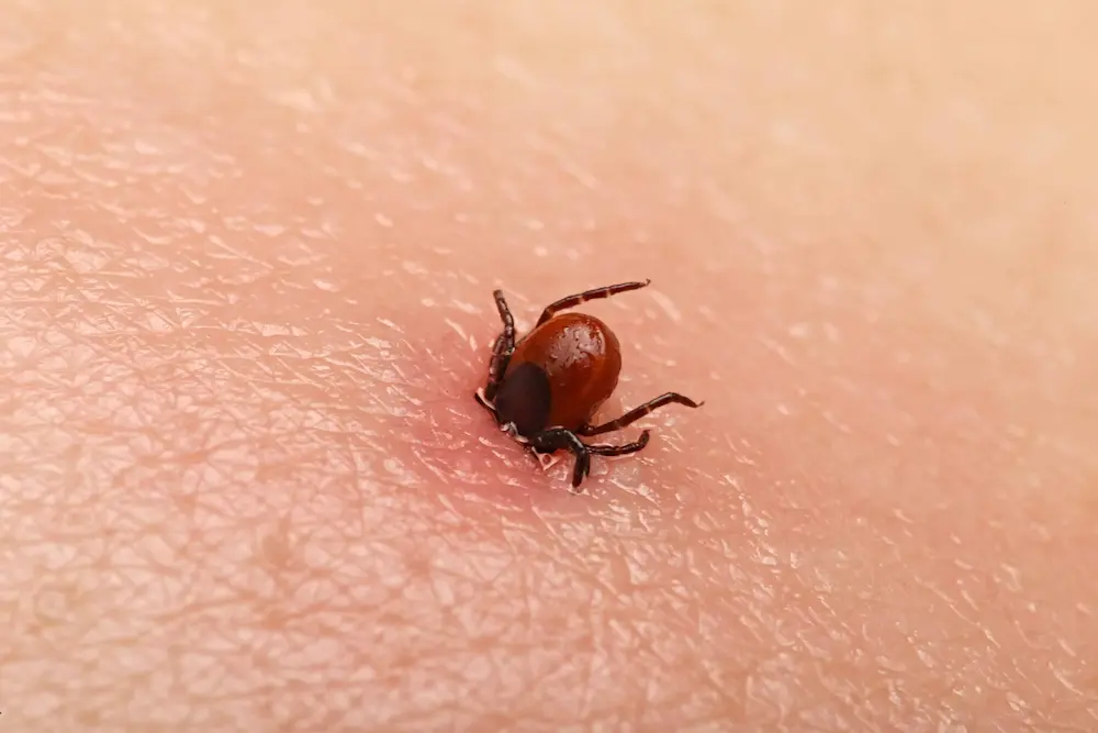 Tick attached to human skin, representing a pest concern.